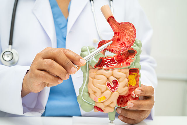 消化器の模型を指差す医師